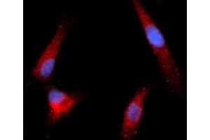Immunofluorescence (IF) image for anti-Granzyme B (GZMB) (AA 21-247) antibody (APC) (ABIN5564760) (GZMB Antikörper  (AA 21-247) (APC))