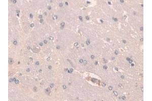 Detection of SCGN in Mouse Cerebrum Tissue using Polyclonal Antibody to Secretagogin (SCGN) (SCGN Antikörper  (AA 1-276))