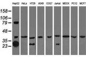 Western blot analysis of extracts (35 µg) from 9 different cell lines by using anti-QPRT monoclonal antibody. (QPRT Antikörper)