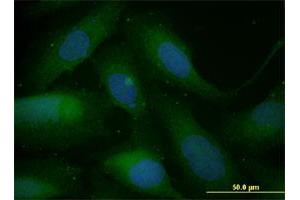 Immunofluorescence of monoclonal antibody to SNAI1 on U-2 OS cell. (SNAIL Antikörper  (AA 121-230))