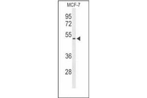 Western blot analysis of FLVC2 Antibody (C-term) in MCF-7 cell line lysates (35ug/lane). (FLVCR2 Antikörper  (C-Term))