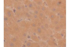 Immunohistochemistry (IHC) image for anti-Tryptase alpha/beta 1 (TPSAB1) (AA 161-262) antibody (ABIN7433105)