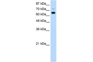 WB Suggested Anti-MGC27016 Antibody Titration:  0.