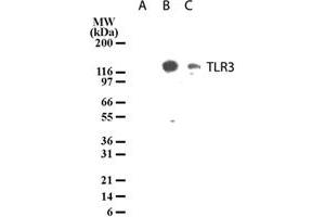 Western blot analysis of TLR3 in lysates from untransfected 293 cells (lane A), 293 cells transfected with human TLR3 cDNA (lane B), and 20 ug/lane human intestine tissue lysate (lane C). (TLR3 Antikörper  (AA 55-85))