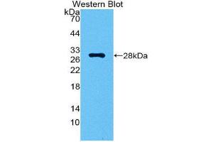 Western Blotting (WB) image for anti-Carbonic Anhydrase II (CA2) (AA 1-260) antibody (ABIN1858403) (CA2 Antikörper  (AA 1-260))
