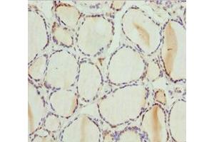 Immunohistochemistry of paraffin-embedded human thyroid tissue using ABIN7163421 at dilution of 1:100 (PSPH Antikörper  (AA 1-225))
