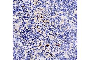 Immunohistochemistry of paraffin embedded mouse spleen using CXCR1 (ABIN7073465) at dilution of 1: 2000 (400x lens) (CXCR1 Antikörper)