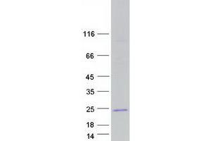 Western Blotting (WB) image for LIM Domain Only 2 (Rhombotin-Like 1) (LMO2) (Transcript Variant 1) protein (Myc-DYKDDDDK Tag) (ABIN2730872)