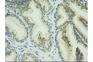 Immunohistochemical staining of paraffin-embedded Human prostate tissue using anti-C17orf28 mouse monoclonal antibody. (HID1/DMC1 Antikörper)