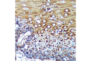 Immunohistochemistry of paraffin-embedded Human esophageal using SPECC1L Rabbit pAb (ABIN7270521) at dilution of 1:100 (40x lens). (SPECC1L Antikörper  (AA 200-500))