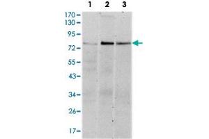 Western blot analysis using RPS6KA3 monoclonal antobody, clone 4E10  against HeLa (1), MCF-7 (2), and HepG2 (3) cell lysate. (RPS6KA3 Antikörper)