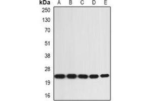 Western blot analysis of IL-36A expression in SW480 (A), A431 (B), mouse skin (C), mouse heart (D), rat liver (E) whole cell lysates. (IL36A/IL1F6 Antikörper)
