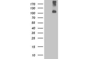 Western Blotting (WB) image for anti-Leucine-Rich Repeat Containing G Protein-Coupled Receptor 4 (LGR4) (AA 230-540) antibody (ABIN1491240) (LGR4 Antikörper  (AA 230-540))