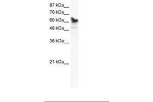 Image no. 1 for anti-DEAD (Asp-Glu-Ala-Asp) Box Polypeptide 41 (DDX41) (AA 447-496) antibody (ABIN202831)