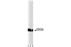 Western blot analysis of caveolin-1 (pY14) on lysates from A431 cells (Human epithelial carcinoma, ATCC CRL-1555) treated with 100 ng/mL EGF.