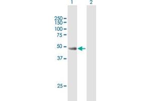Western Blot analysis of CYLC2 expression in transfected 293T cell line by CYLC2 MaxPab polyclonal antibody. (CYLC2 Antikörper  (AA 1-348))