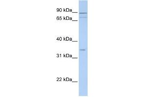 WB Suggested Anti-TNMD Antibody Titration:  0.