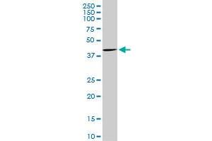 CDX4 monoclonal antibody (M16), clone 1E11. (CDX4 Antikörper  (AA 202-284))