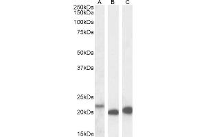 (ABIN570987) (0. (IL-18 Antikörper  (Internal Region))