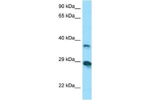 Host:  Rabbit  Target Name:  VSIG4  Sample Tissue:  Human COLO205 Whole Cell  Antibody Dilution:  1ug/ml (VSIG4 Antikörper  (N-Term))