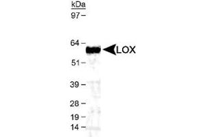 Western blot analysis of LOX in mouse kidney lysate using LOX polyclonal antibody  (1 : 1,000). (LOX Antikörper  (AA 200-300, AA 300-400))