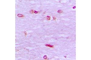 Immunohistochemistry (IHC) image for anti-BRF1, RNA polymerase III transcription initiation factor subunit (BRF1) (Center) antibody (ABIN7295852)