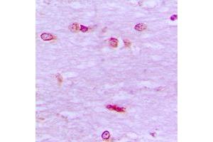 Immunohistochemical analysis of BRF1 staining in human brain formalin fixed paraffin embedded tissue section. (BRF1 Antikörper  (Center))