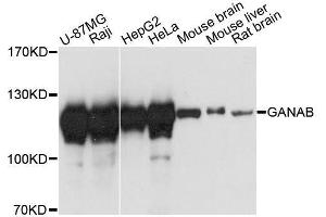 Western blot analysis of extracts of various cell lines, using GANAB antibody. (GANAB Antikörper  (AA 1-260))