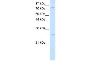 RBM28 antibody used at 0.