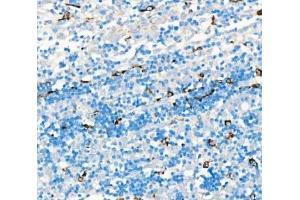 IHC analysis of CD68 using anti-CD68 antibody (ABIN7600142). (CD68 Antikörper  (AA 154-354))