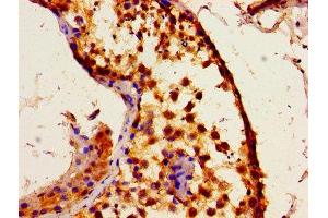 Immunohistochemistry of paraffin-embedded human testis tissue using ABIN7156293 at dilution of 1:100 (ITPR1 Antikörper  (AA 1707-1966))