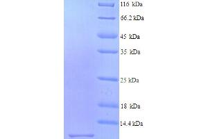 SDS-PAGE (SDS) image for Stimulator of Chondrogenesis 1 (SCRG1) (AA 21-98) protein (His tag) (ABIN5714294) (SCRG1 Protein (AA 21-98) (His tag))