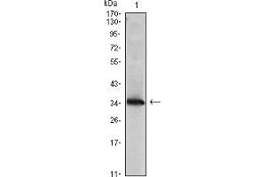Western blot analysis using NME1 mAb against NME1(AA: 27-177)-hIgGFc transfected HEK293 cell lysate. (NME1 Antikörper)