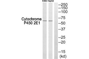 Western Blotting (WB) image for anti-Cytochrome P450, Family 2, Subfamily E, Polypeptide 1 (CYP2E1) (C-Term) antibody (ABIN1850358)