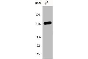 Western Blot analysis of 293 cells using DGK-ι Polyclonal Antibody (DGKI Antikörper  (C-Term))