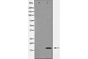 Western blot analysis of COX IV expression in Jurkat cells. (COX IV Antikörper  (Internal Region))