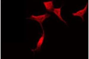ABIN6275408 staining HeLa by IF/ICC. (PPP1R14D Antikörper  (Internal Region))