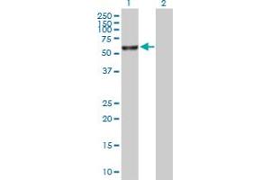 Western Blot analysis of FANCE expression in transfected 293T cell line by FANCE MaxPab polyclonal antibody. (FANCE Antikörper  (AA 1-536))