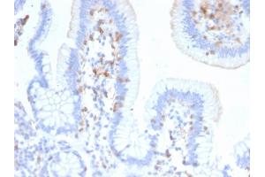 Immunohistochemistry (IHC) image for anti-Integrin, alpha E (Antigen CD103, Human Mucosal Lymphocyte Antigen 1, alpha Polypeptide) (ITGAE) antibody (ABIN6939807)