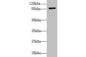 Western blot All lanes: FSCB antibody at 1. (FSCB Antikörper  (AA 1-200))