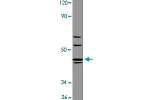 Western blot analysis of A-549 cell lysate with AGTR1 polyclonal antibody  at 1:500 dilution. (Angiotensin II Type-1 Receptor Antikörper  (AA 150-200))
