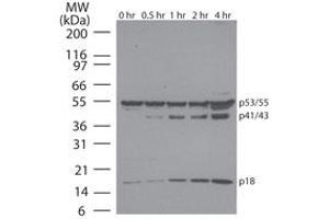 Caspase-8 Western Blot. (Caspase 8 Antikörper)