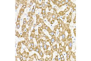 Immunohistochemistry of paraffin-embedded human liver using  Rabbit mAb (ABIN7265363) at dilution of 1:25 (40x lens). (ACAT1 Antikörper)