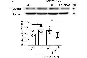 LV-TMEM16F-RNAi transfection downregulates TMEM16F in rat brain. (Anoctamin 6 Antikörper  (AA 744-824))