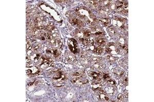 Immunohistochemical staining of human stomach, lower with C19orf47 polyclonal antibody  shows strong cytoplasmic positivity in glandular cells at 1:50-1:200 dilution. (C19orf47 Antikörper)