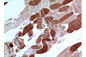 Immunohistochemistry (IHC) analysis of paraffin-embedded Human Muscle, antibody was diluted at 1:100. (ATP2A2 Antikörper  (C-Term))