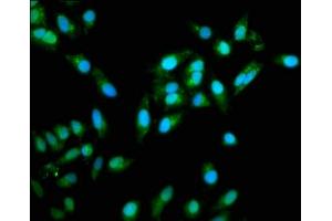 Immunofluorescence staining of Hela cells with ABIN7172247 at 1:333, counter-stained with DAPI. (TRAF6 Antikörper  (AA 1-522))