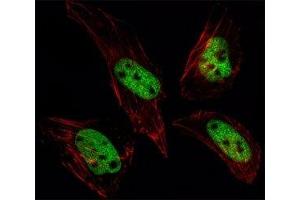 Fluorescent image of HeLa cells stained with SUMO antibody at 1:25. (SUMO1 Antikörper  (AA 52-79))