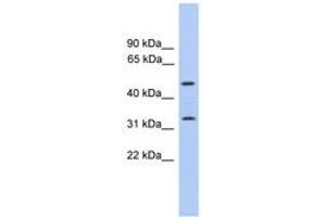 Image no. 1 for anti-Tumor Protein P63 Regulated 1 (TPRG1) (C-Term) antibody (ABIN6746427) (TPRG1 Antikörper  (C-Term))