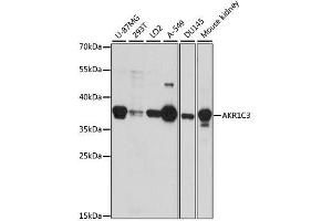 Western Blotting (WB) image for anti-Aldo-Keto Reductase Family 1, Member C3 (3-alpha Hydroxysteroid Dehydrogenase, Type II) (AKR1C3) (AA 1-323) antibody (ABIN3022536)